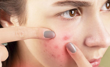 Estresse na pele: 9 indicativos de que você deve cuidar melhor do seu emocional